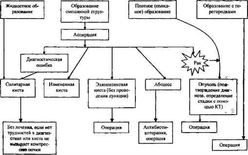 Диагностическая тактика при ультразвуковой диагностике опухолей почки (Игнашин Н. С., 1990)