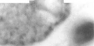 Рис.18. Мотонейрон переднего рога V шейного сегмента спинного мозга. Контуры цитоплазмы грушевидной формы. Цитоплазма вакуоли- зирована и заполнена липофусцином, ядро эктопировано и деформировано, ядрышко увеличено. Окраска тионином по Нисслю. Ув. 1400.