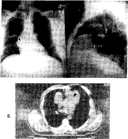 Рис. 6~5, Прямая и боковая рентгенограммы 