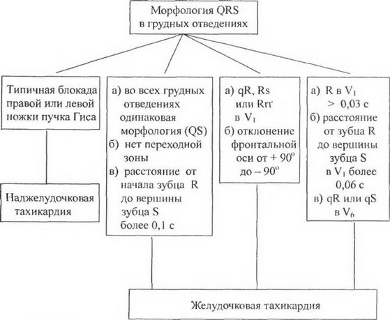 Схема 4. Дифференциальная диагностика пароксизмальных тахикардий при наличии на ЭКГ уширенных желудочковых комплексов (ОД 2 с и более) и при невозможности идентификации зубца Р