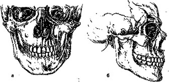 Рис. 5. Положение зубных рядов в центральной окклюзии