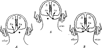 Рис. 3.3. Дихотическое прослушивание у испытуемых с расщепленным мозгом.