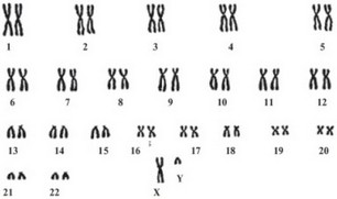 Рис. 7. Вид под микроскопом полного набора хромосом, содержащихся в ядре каждой отдельной клетки человека