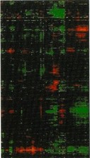 Рис. 31. Общая картина гибридизации меченых флюоресцентными красителями зондов с микрочином, изображающая спектры генов, работающих сильнее (красным цветом) или слабее (зеленым цветом) в раковых клетках по сравнению с нормальными клетками.