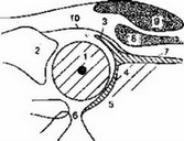 Рис. 43. Графическая схема строения тазобедренного сустава при улътрозвуковом исследовании