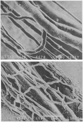 Рис. 3. Различия строения капиллярной сети корневой пульпы. Коррозионные препараты микрососудов пульпы зубов собаки (электронная микроскопия).