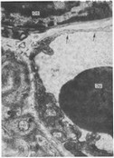 Рис. 6. Фенестрация (указано стрелками) эндотелия в гемокапилляре