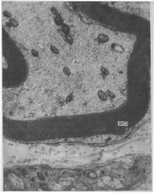 Рис. 9. Миелиновое волокно в корневой пульпе зуба человека (электронная микроскопия) .X1200.
