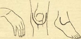 Рис. 41. Разрезы для вскрытая лучезапястного, коленного и голеностопного суставов.