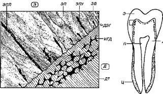 Рис. 5-5. Эмалевые пластинки, пучки и веретена (показан участок шлифа зуба в области дентино-эмалевой границы, отмеченный на рисунке справа).