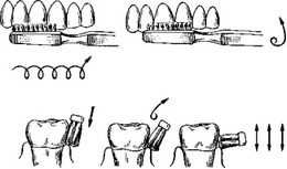 Рис. 27. Направления движения зубной щетки при проведении гигиенических процедур.