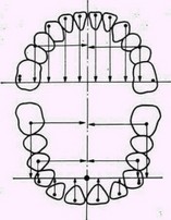 Рис. 39. Методика определения сагиттальных и трансверсальных размеров зубных дуг (объяснение в тексте)