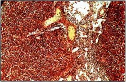 Фото 5 Паховый лимфатический узел крысы-самки на 10-е сутки послеродового периода (без раны), окраска по Ван Гизону, х 1000