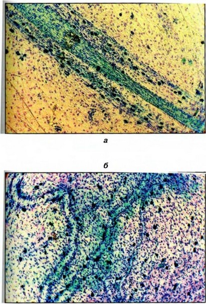 Фото 7 Брыжейка тонкой кишки крысы-самки, окраска по Горчакову, х 1000 а — расположение тучных клеток вдоль сосудов, б — хаотичный характер расположения тучных клеток в межсосудистых участках